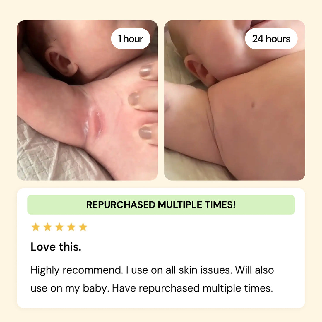 Mom’s Best Friend Bundle — view 8