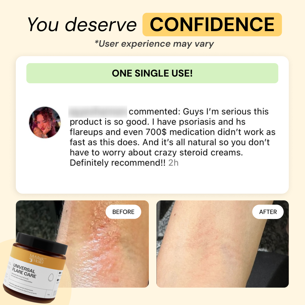 Comfort Flare Care Set — view 8