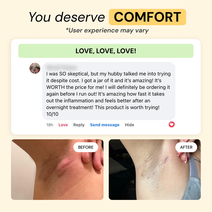 For skin that reacts to everything else