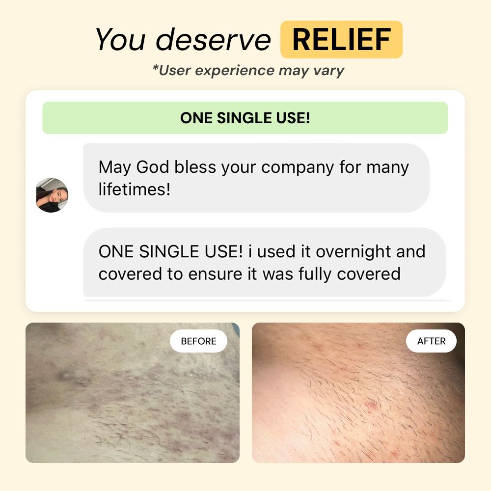 Thyme & Tea Tree Flare Care — view 7