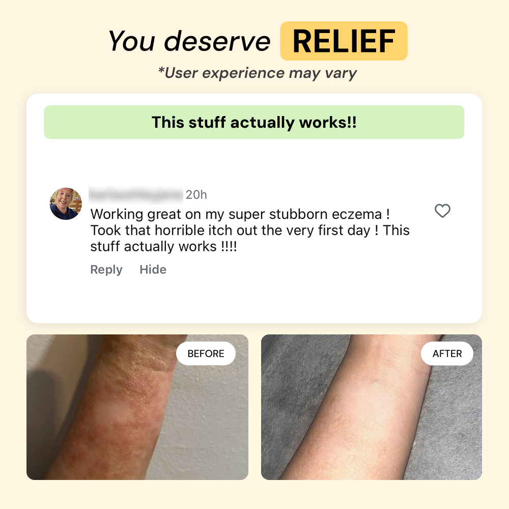 Dry + Reactive Skin Daily Care Bundle — view 6