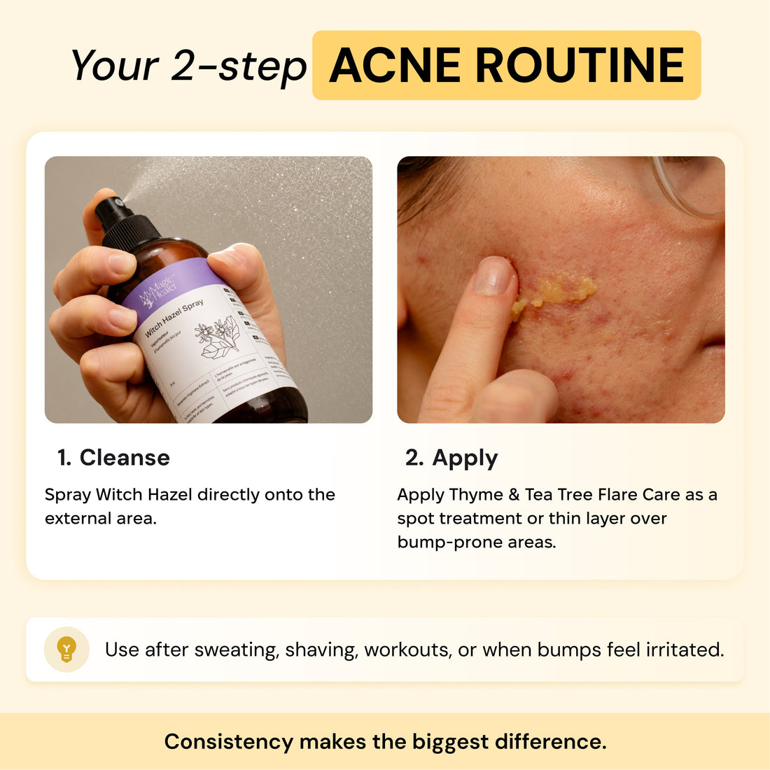 2-Step Acne Routine — view 4