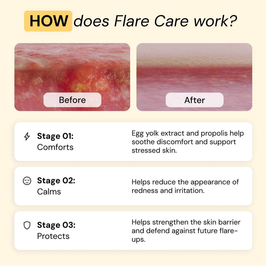 Universal Flare Care — view 5