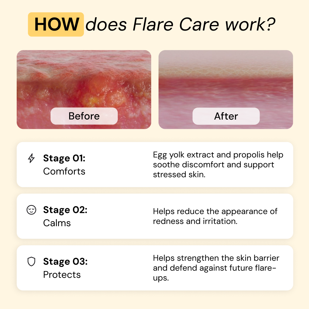 Complete Flare Care Duo | 4oz — view 5