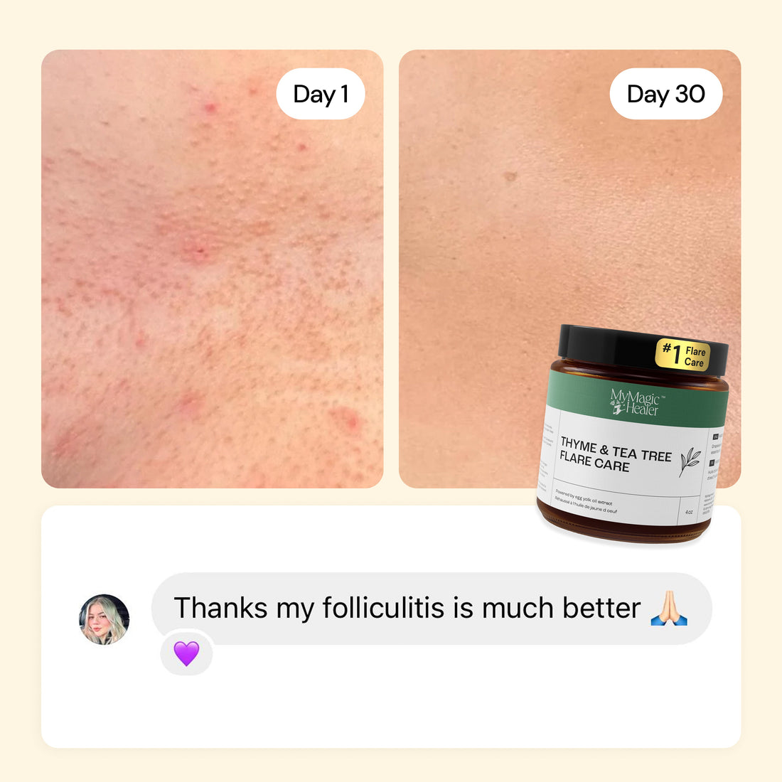 Flare Care Favorites Collection — view 8