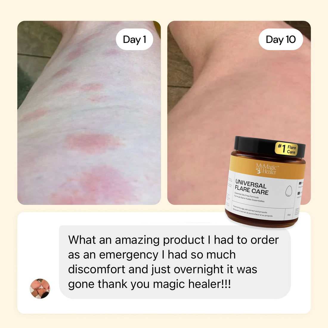 Flare Care Favorites Collection — view 9