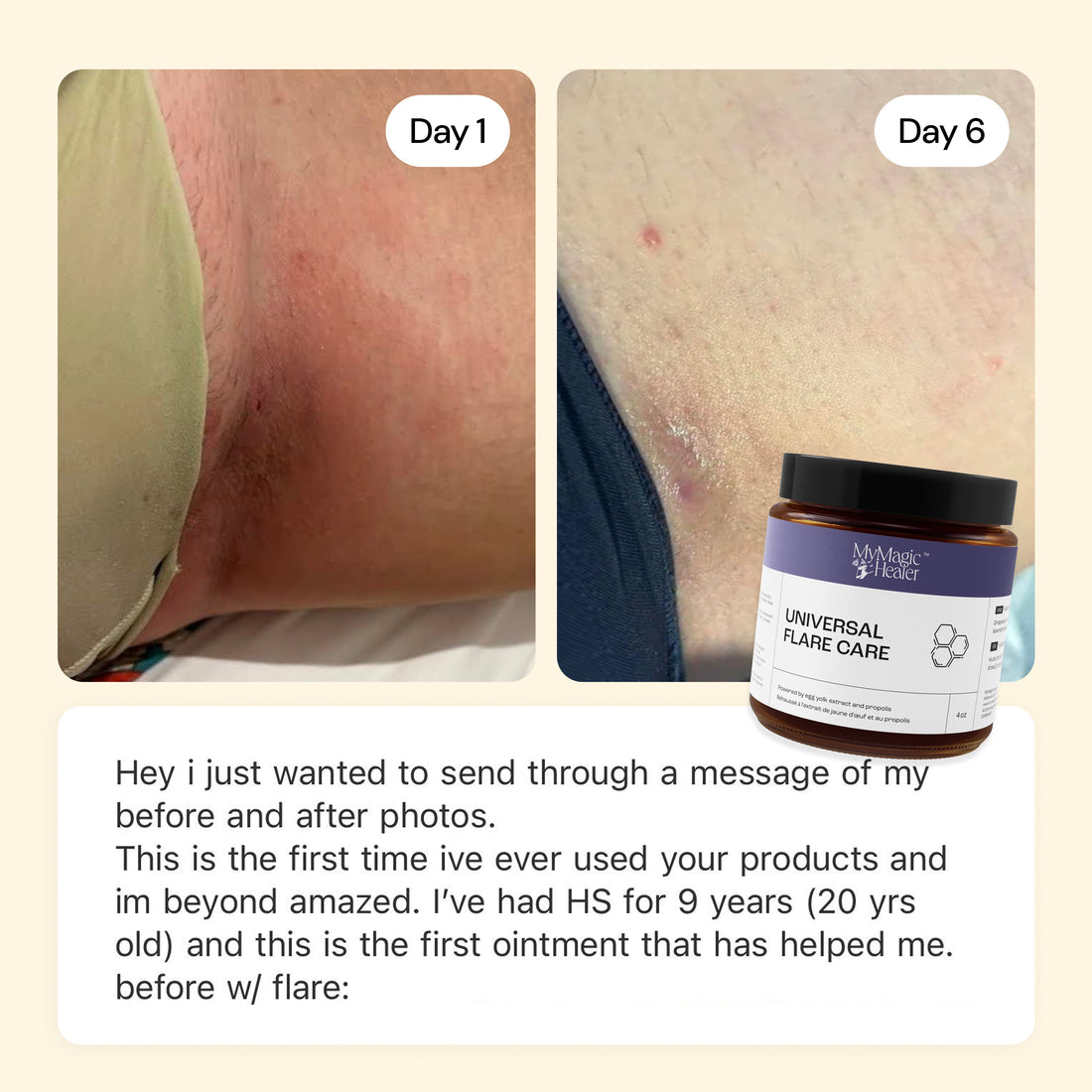 Flare Care Favorites Collection — view 10