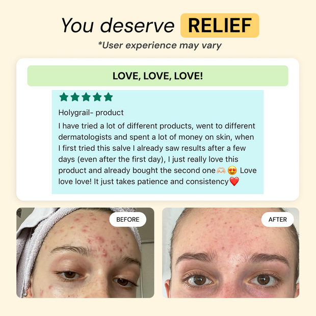 Customer photo and message about Thyme & Tea Tree Flare Care