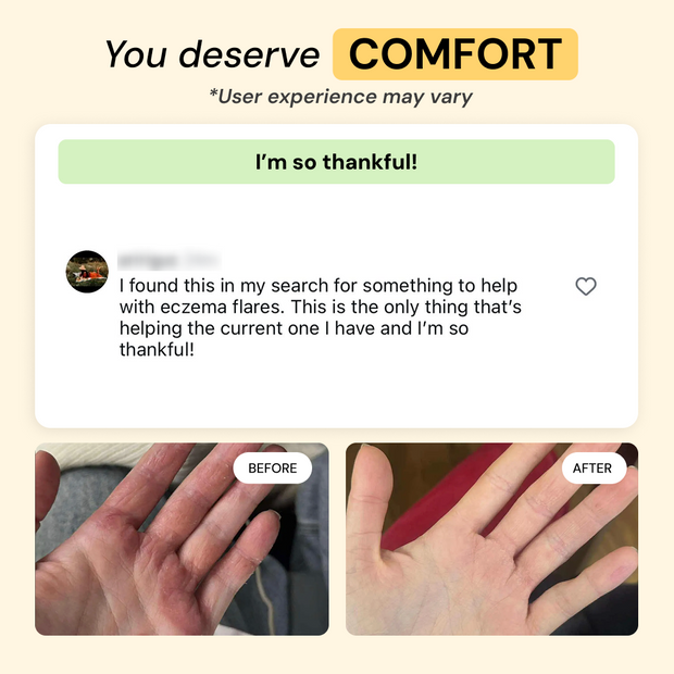 Customer photo and message about Dry + Reactive Skin Daily Care Bundle