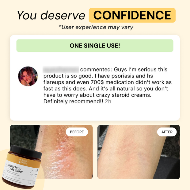 Customer photo and message about Comfort Flare Care Set
