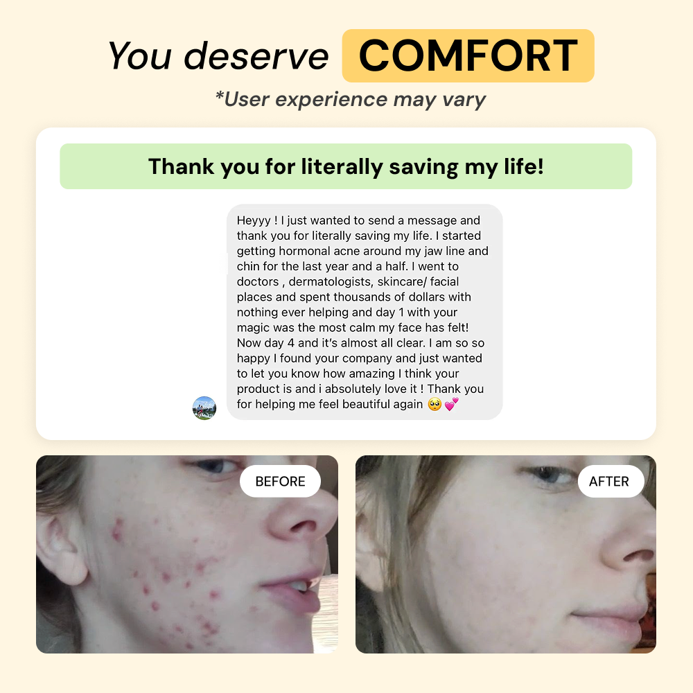 2-Step Acne Routine — view 6