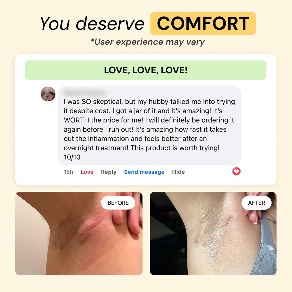 Universal Flare Care | Essential Oil Free — view 6