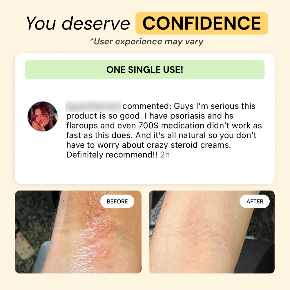 Universal Flare Care | Essential Oil Free — view 8