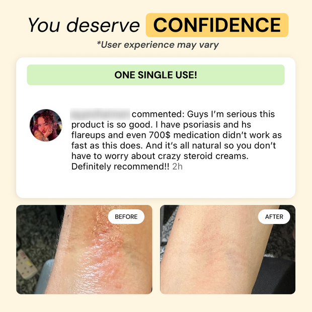 Customer photo and message about Universal Flare Care | Essential Oil Free