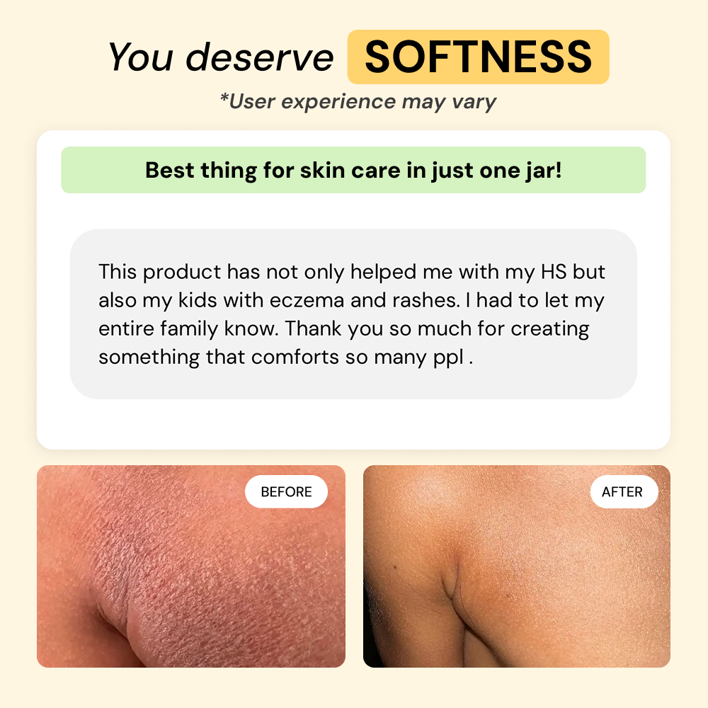 Dry + Reactive Skin Daily Care Bundle — view 8