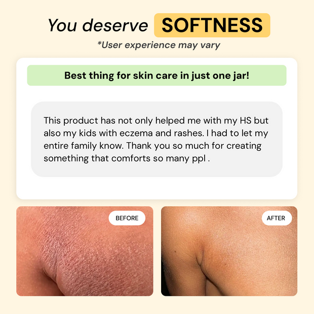 Customer photo and message about Dry + Reactive Skin Daily Care Bundle