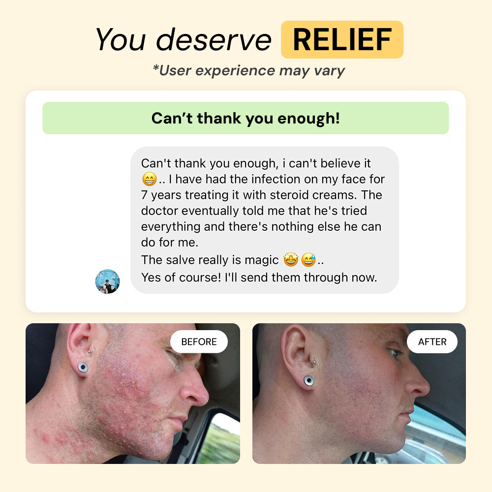 Thyme & Tea Tree Flare Care — view 8