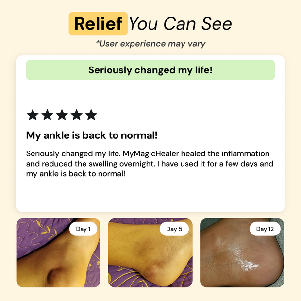 Customer photo and message about Comfrey & Arnica Relief