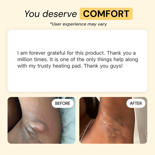 Customer photo and message about Universal Flare Care