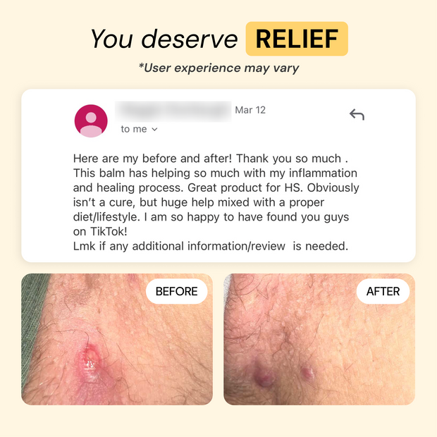 Customer photo and message about Universal Flare Care