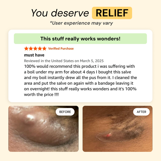 Customer photo and message about Universal Flare Care | Essential Oil Free