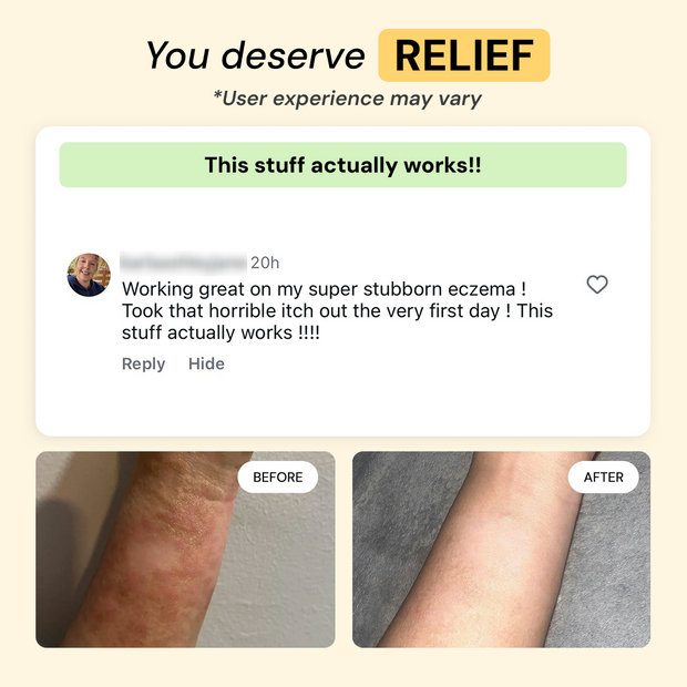 Customer photo and message about Dry + Reactive Skin Daily Care Bundle