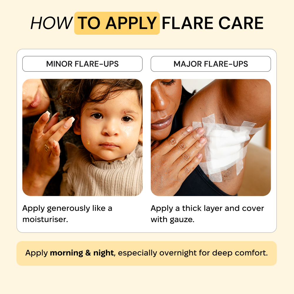 Universal Flare Care | Essential Oil Free — view 10