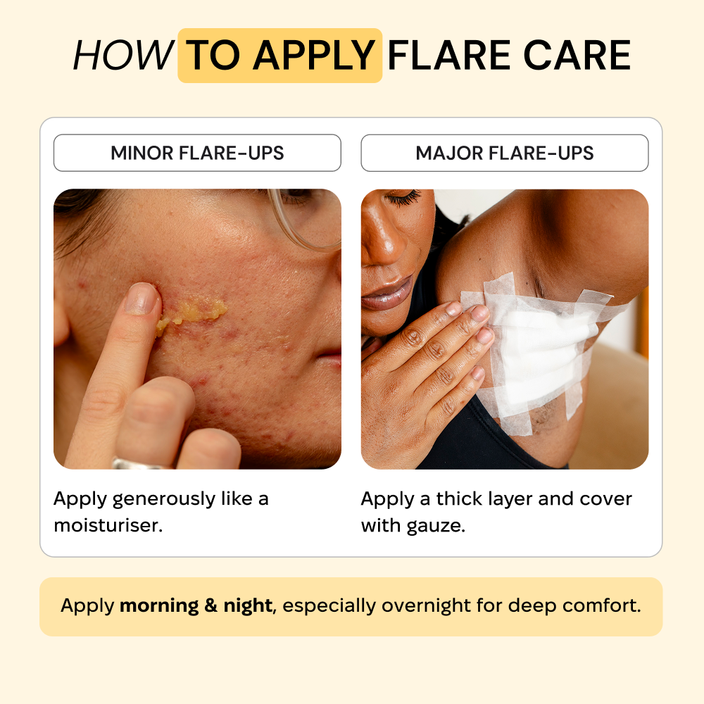 Thyme & Tea Tree Flare Care — view 9