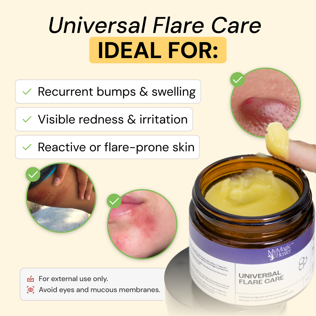 Universal Flare Care — view 3